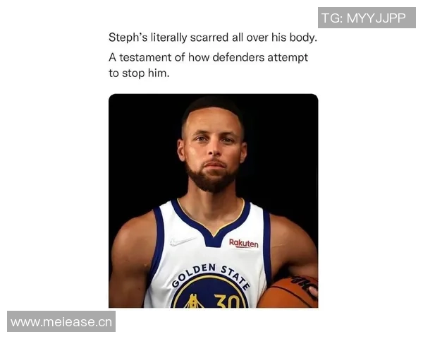 库里谈伤情：血痕源于对湖人比赛实际情况并不严重